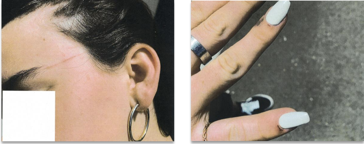 Photos of injuries a Mesa Middle School student claimed she received at the hands of her eighth grade math teacher on April 25, 2023. The left photo shows what the student claimed was a papercut from the teacher throwing papers. The right photos shows injuries to fingers the student claimed she suffered when the teacher took a hairbrush out of her hand.