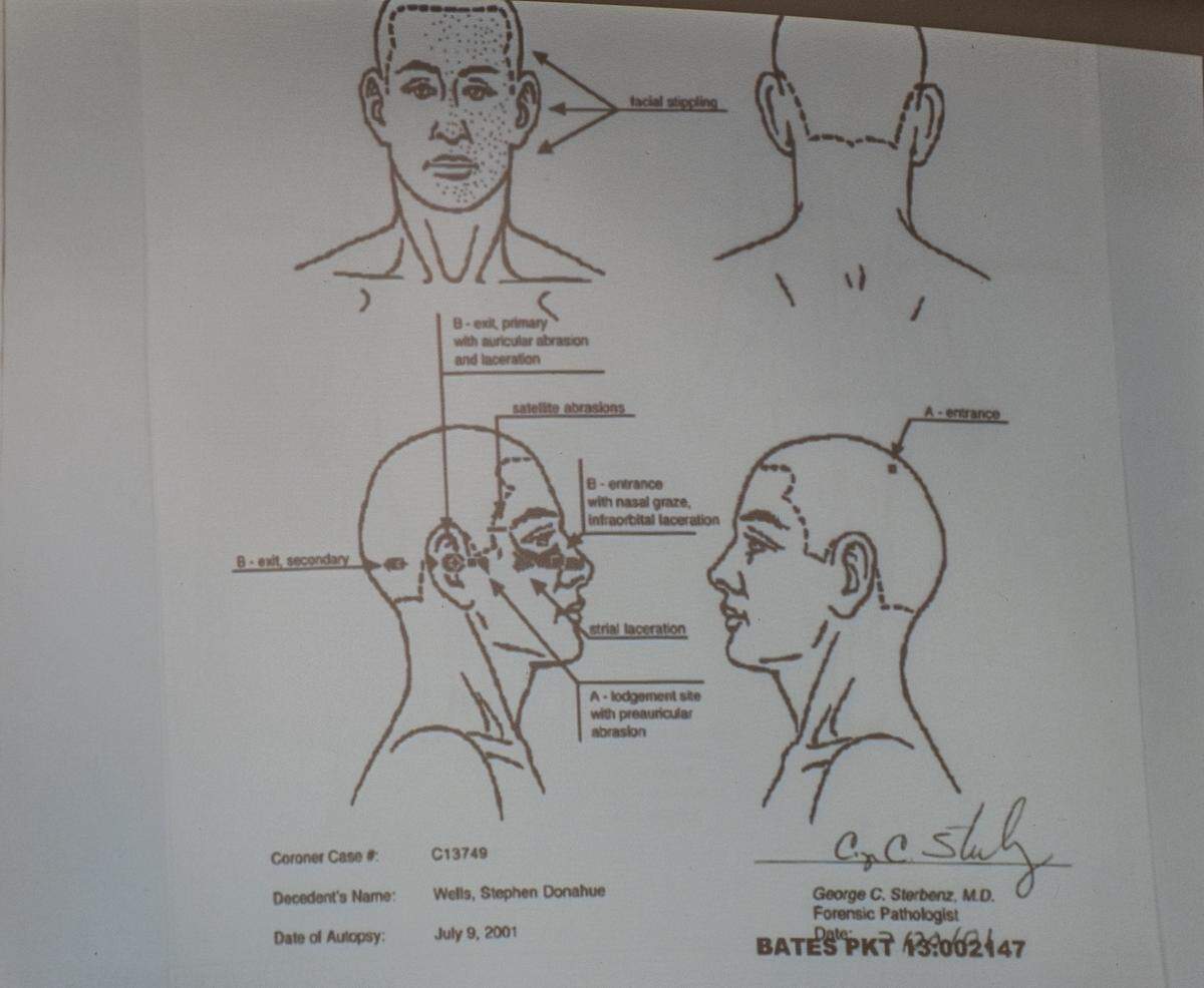 A diagram of the bullet wounds suffered by Stephen Wells is shown to the jury hearing the case against Stephen Deflaun in San Luis Obispo Superior Court on April 10, 2023.