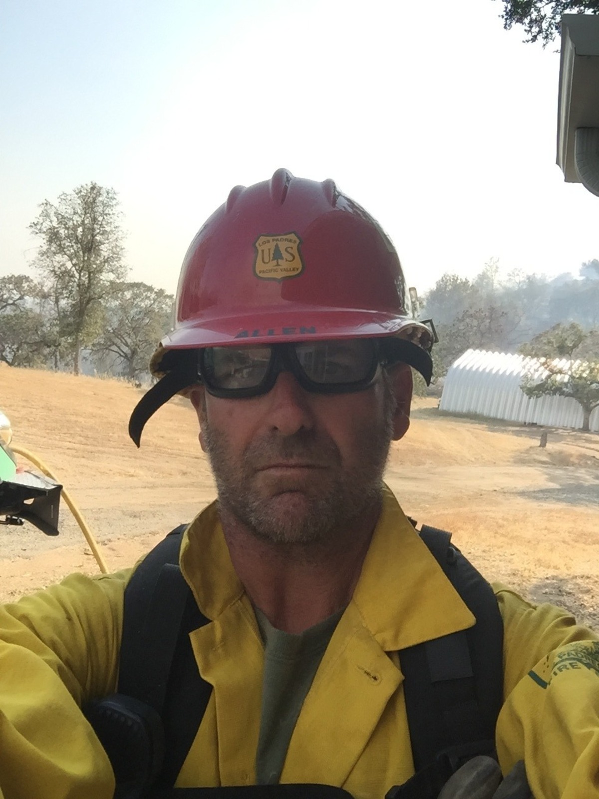 Fire Captain Casey Allen is still recovering five months after being critically burned in the Dolan Fire near Big Sur.
