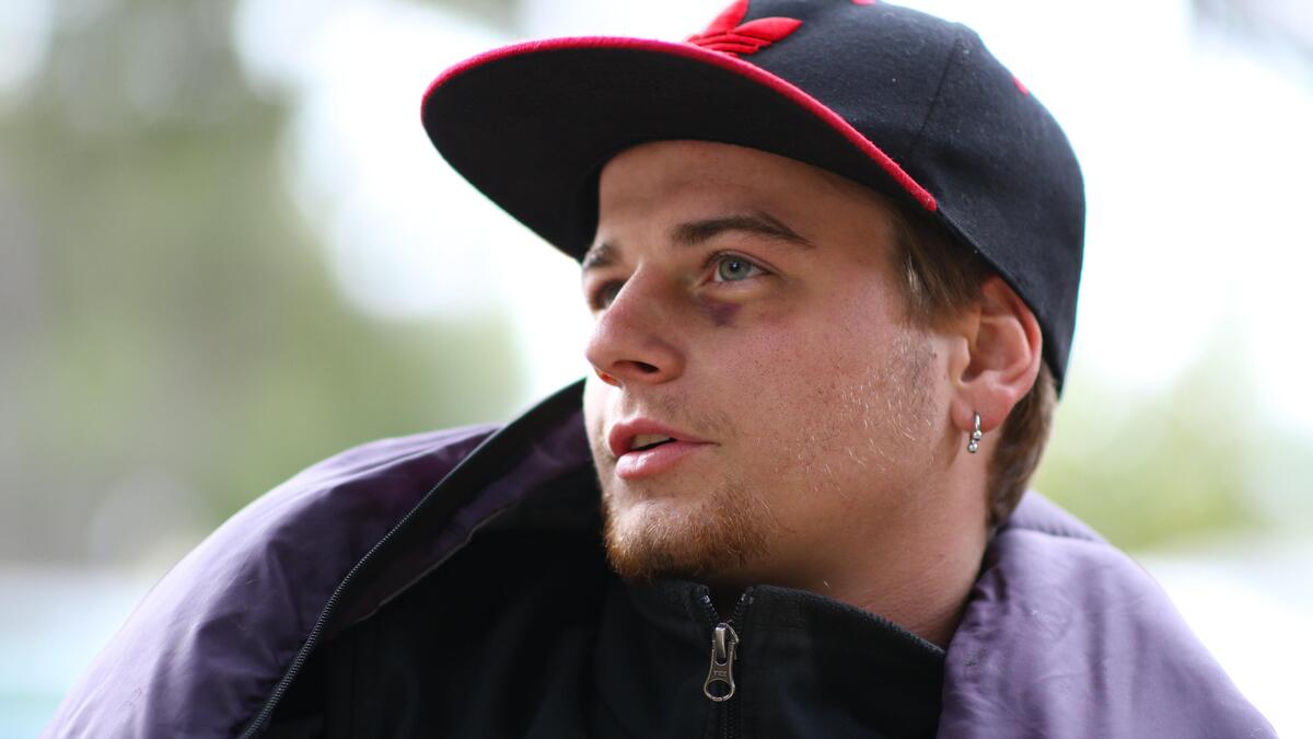 Justus Keefover, 22, has been living near Atascadero Creek for the last two weeks and thinks the increased patrols are heavy-handed. He got the black eye from someone he knew but said, “I deserved it.”