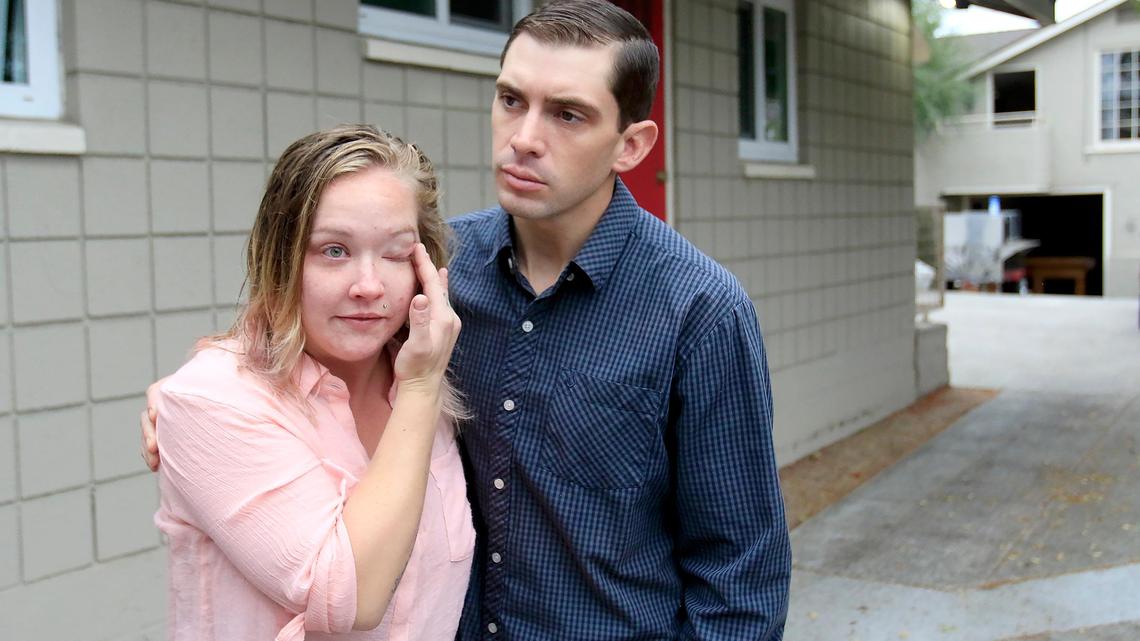 SLO reaches settlement with couple after police officer shot their dog