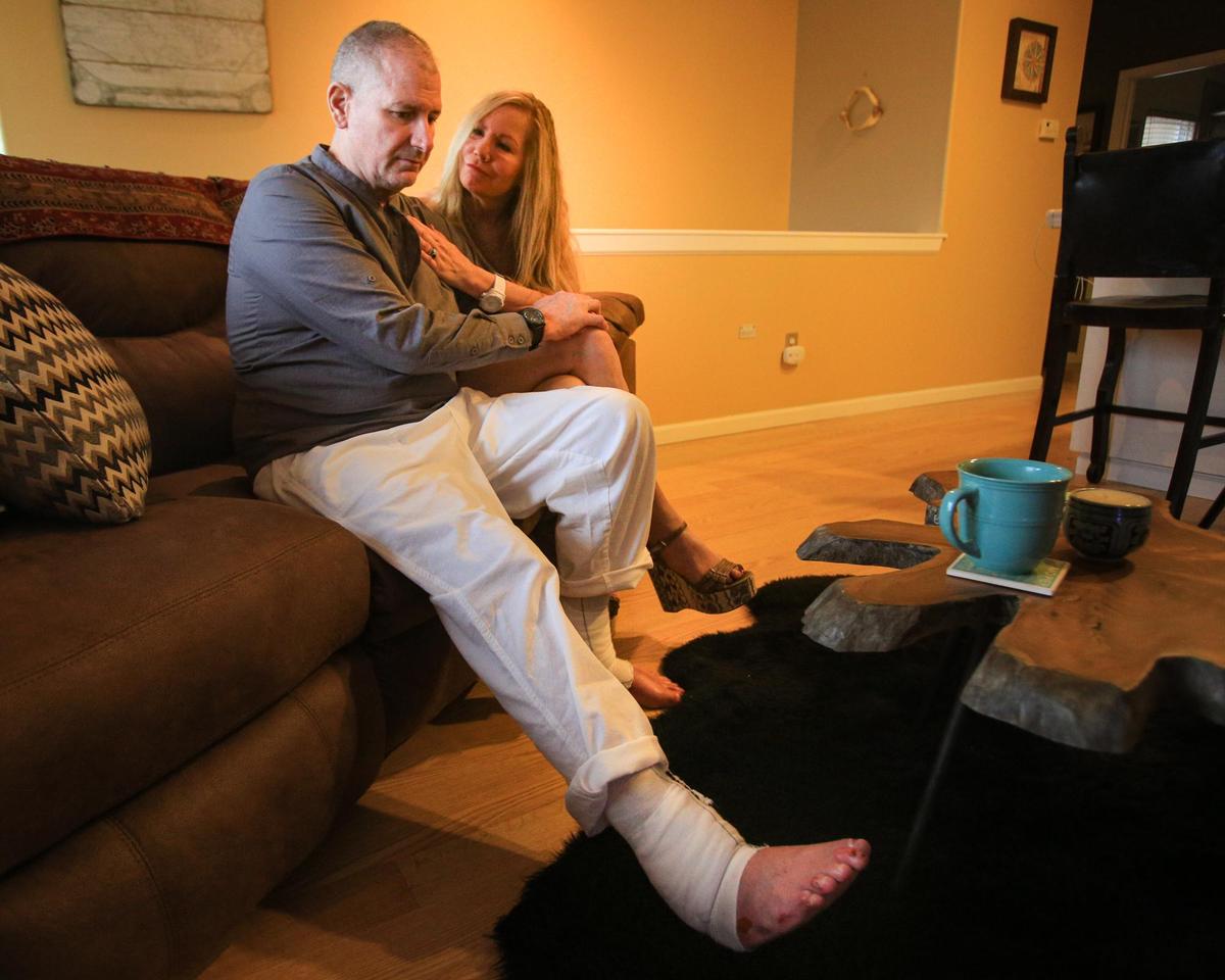 Pismo Beach firefighter Casey Allen was injured while battling the Dolan Fire near Big Sur, Nearly five months after he sustained second- and third-degree burns over more than 40% of his body, Allen and his fiancée, Tina Nott, are focused on healing.