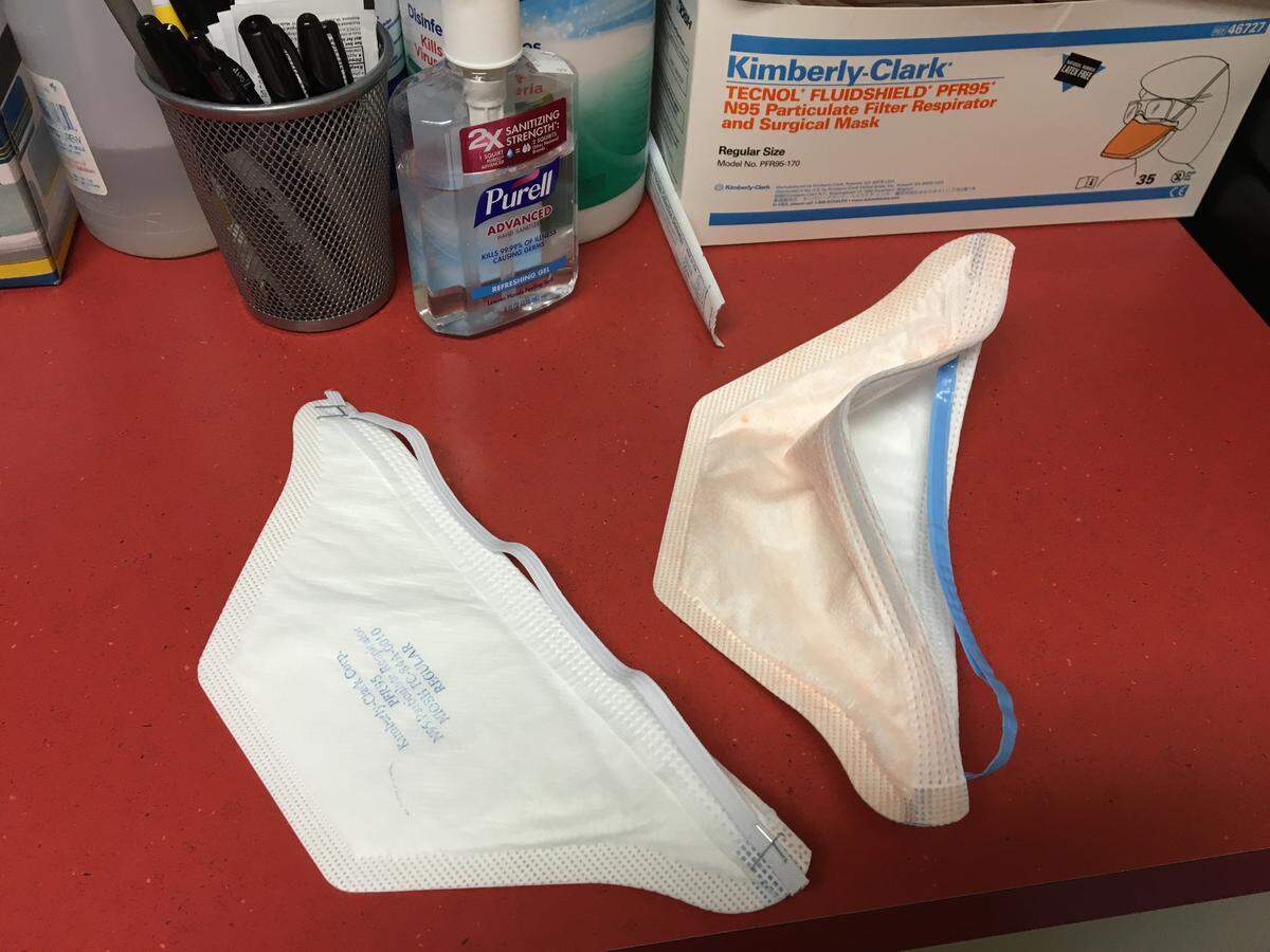 Short on medical supplies, Dr. William Morgan’s pediatric care office in Arroyo Grande used pieces of elastic and staples to make use of a box of defective N95 masks.