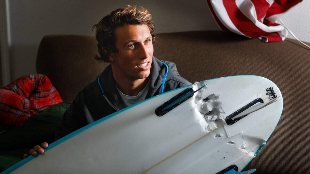 Nick Wapner, a 19-year-old Cal Poly student, was attacked by a great white shark at Montana de Oro on Jan. 8. Wapner suffered cuts to his legs and received 50 stitches. He kicked the shark in the head to break free of its grasp on his ankles.