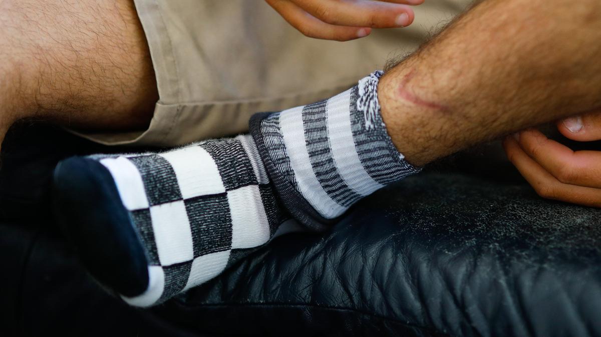 A January 2019 shark attack left Cal Poly student Nick Wapner with scars on his legs, but he did not have permanent damage.