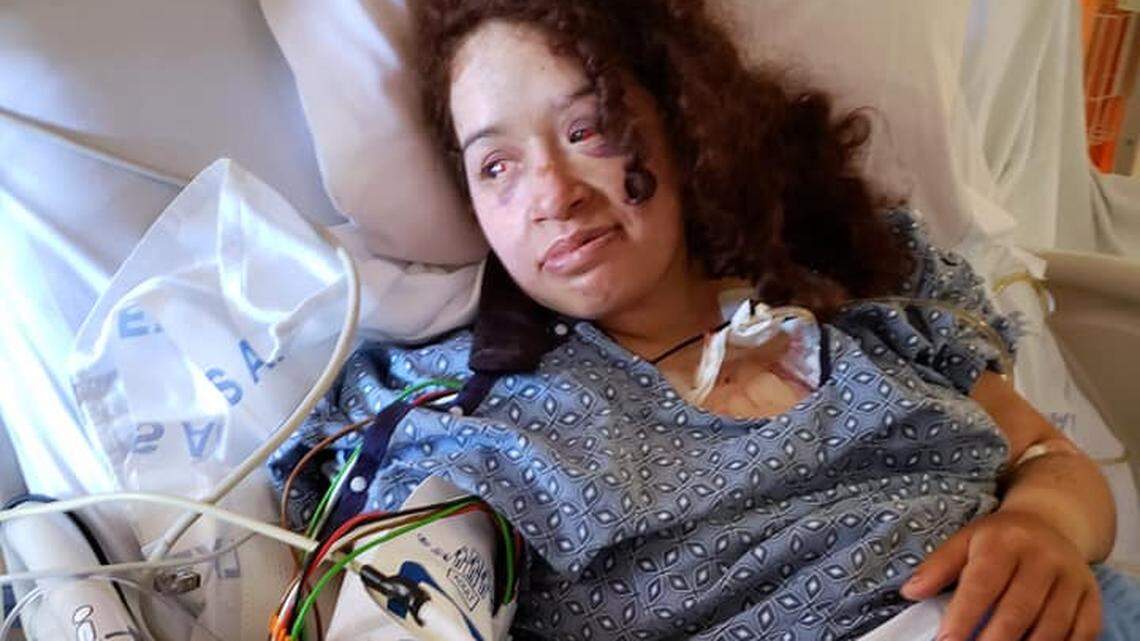Angela Hernandez posted this photo of her in the hospital following her crash in Big Sur.