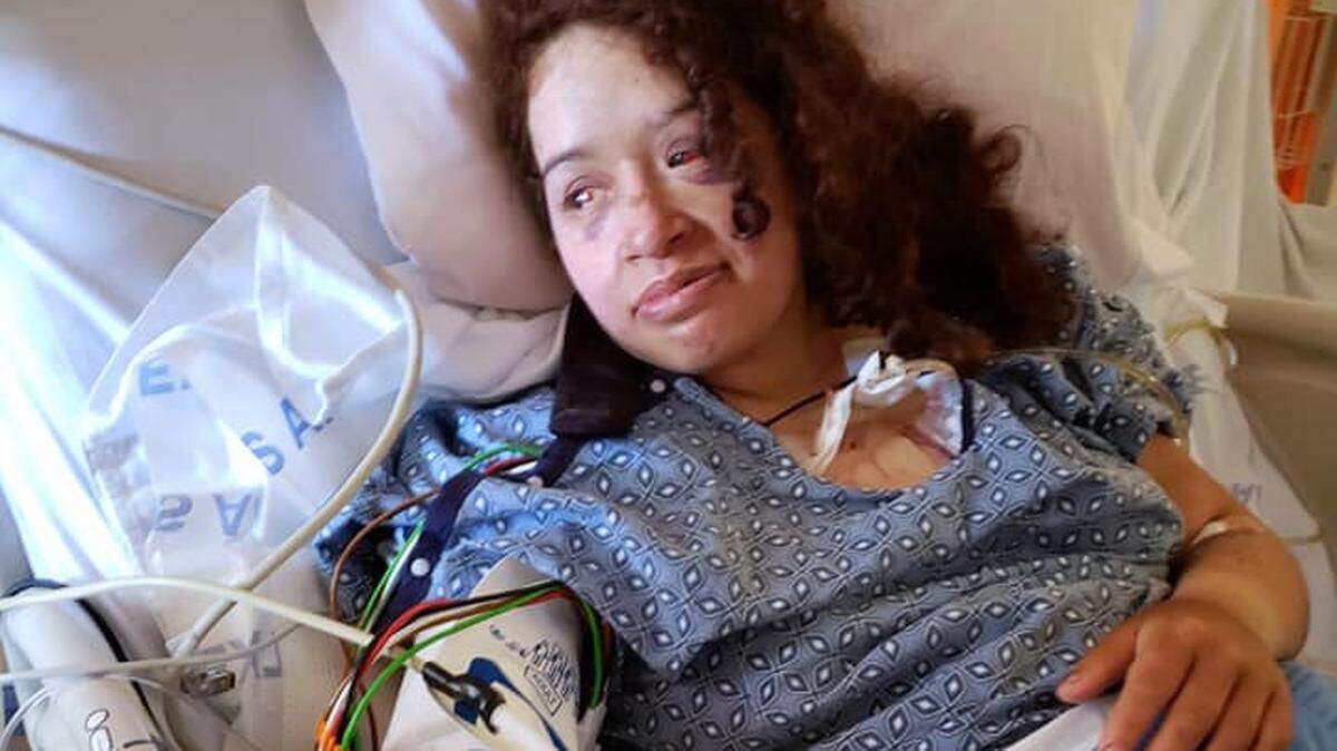 Angela Hernandez posted this photo of her in the hospital following her crash in Big Sur.