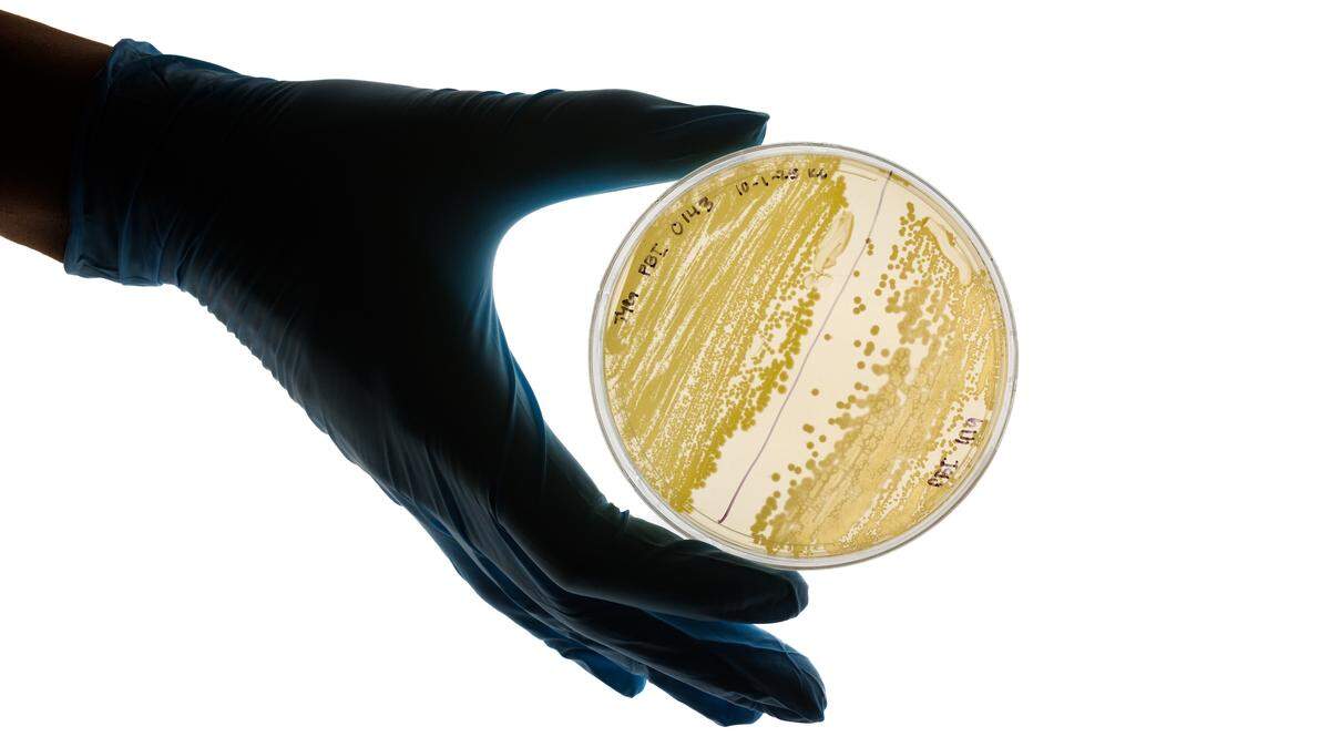A Cal Poly research team is studying ancient bacteria found isolated in amber and other materials for antibiotic properties and resistance. Here, a bacteria strain dating back millions of years was grown in a Petri dish.