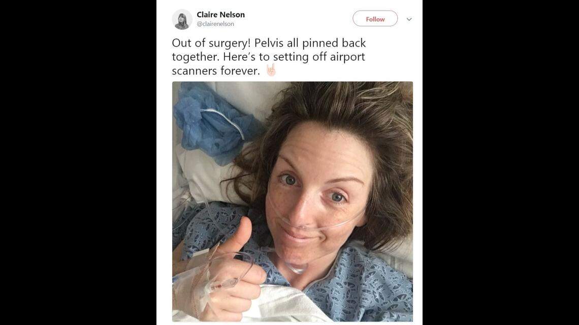 Claire Nelson, a New Zealand native, went for a hike in Joshua Tree National Park on May 22 when she fell and was seriously injured. Responders found her four days later, on May 25, and she is recovering in a Palm Springs hospital.