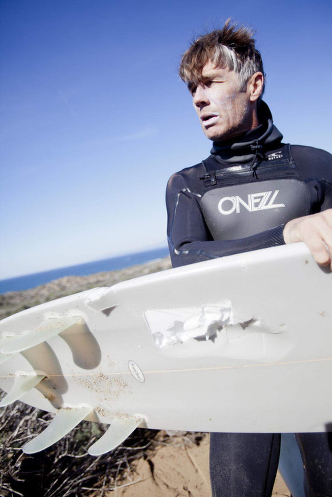 Morro Bay surfer Andrew Walsh holds the board that his surfing partner, Kevin Swanson, was on when he was attacked by a shark in Montaña de Oro State Park. He helped Swanson paddle back to shore and got help. 