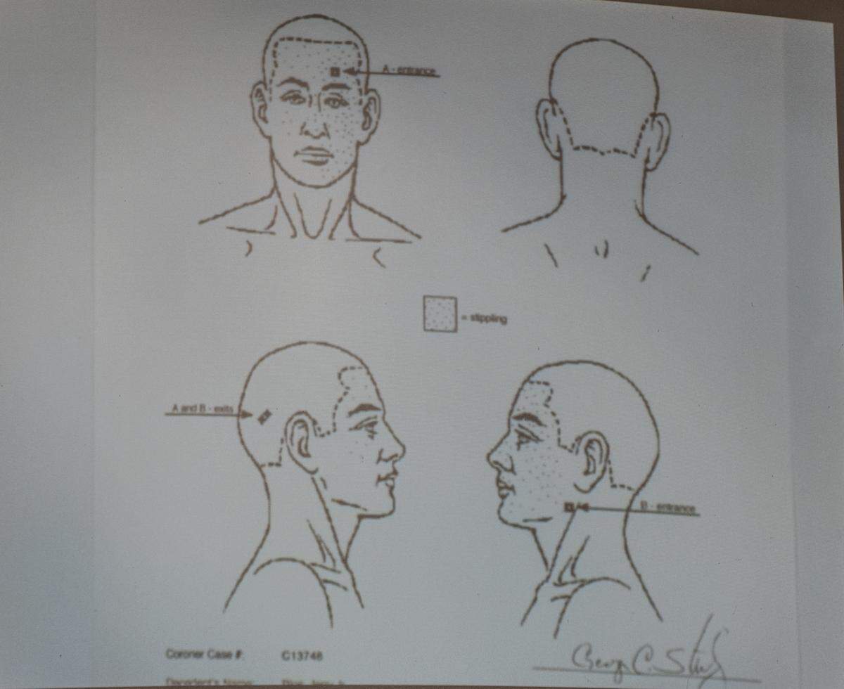 A diagram of the bullet wounds suffered by 11-year-old Jerry Rios Jr. is shown to the jury hearing the murder trial against Stephen Deflaun in San Luis Obispo County Superior Court on April 10, 2023.