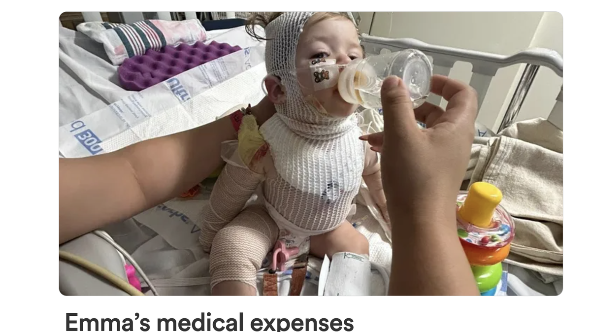 A family is seeking help through Gofundme after a baby suffered serious burns in a fireworks accident in Paso Robles on July 4, 2024.