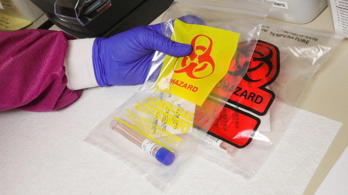 San Luis Obispo County Public Health lab technician Elizabeth Farrington holds a nasal swab sample to be tested for coronavirus.