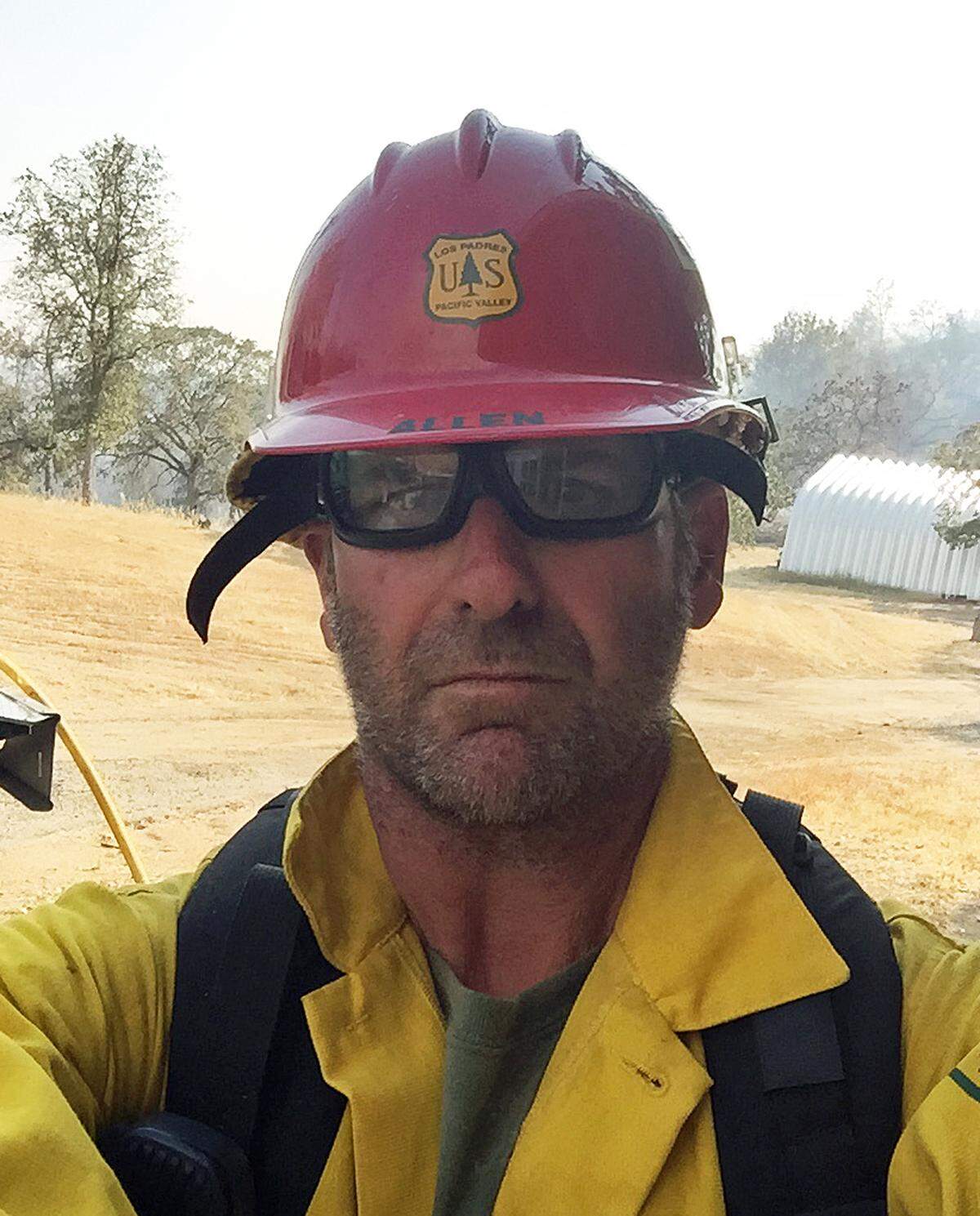 Fire Capt. Casey Allen of Pismo Beach is still recovering from burn injuries he incurred while fighting the Dolan Fire in September 2020.
