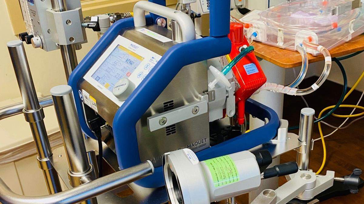 Marian Regional Medical Center has acquired an Extracorporeal Membrane Oxygenation (ECMO) machine, a rare technology for treating some of the most critically ill patients, reportedly making the Santa Maria hospital the only facility between San Francisco and Los Angeles with the life-saving equipment.
