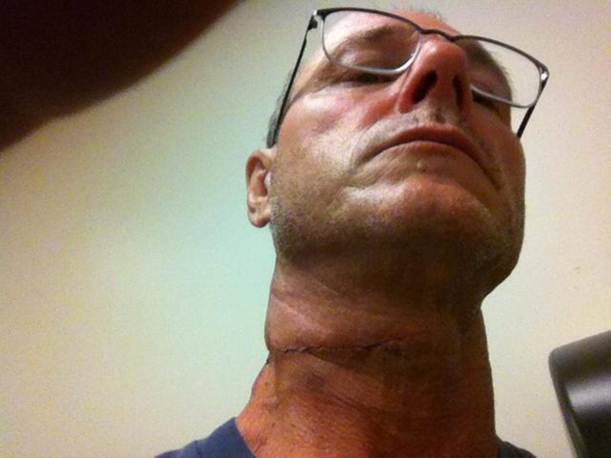 A cellphone camera allegedly captures the scar of former Atascadero resident Robert Johnson's neck wound.