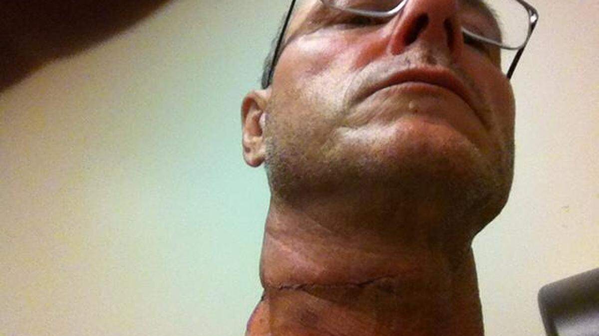 A cellphone camera allegedly captures the scar of former Atascadero resident Robert Johnson's neck wound.