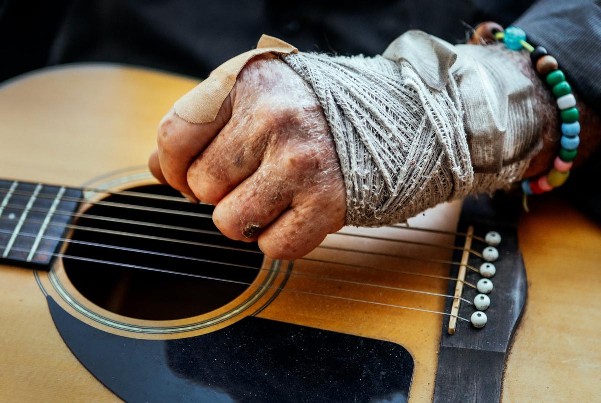 Jon Akeman strums his guitar with a bandage around his sprained wrist which he injured recently.Photo by Joe Johnston 09-12-18