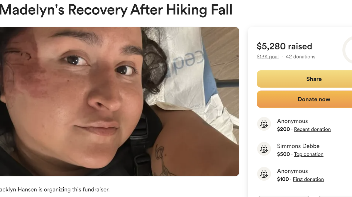 Madelyn Rain, a barber at The Real McCoy Barbershop in Atascadero, recently suffered a major fall while hiking, fracturing three vertebrae and injuring her face. Her employer organized a GoFundMe to raise money to support her during her recovery.