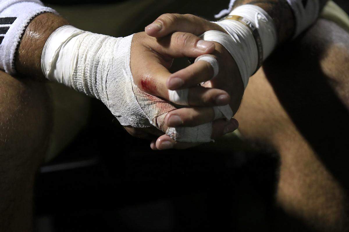 Mustang Victory Johnson bloodied hands.  Cal Poly lost to UC Davis 34-27 in a college football game at Mustang Memorial Stadium on Oct. 4, 2025.