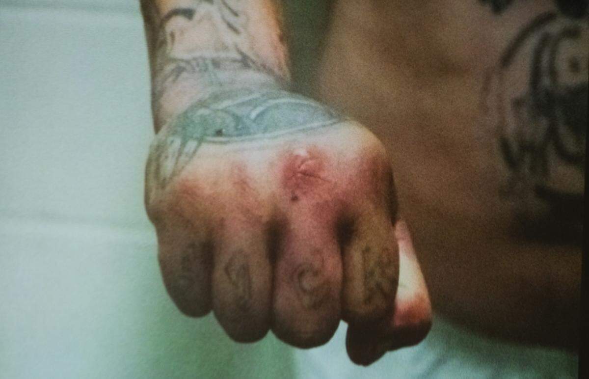 A photo from court on Feb. 2, 2024, shows injuries to Marco Antonio Cota Jr.’s fist on the night he is accused of killing Rick Folwer in a San Luis Obispo creekbed.