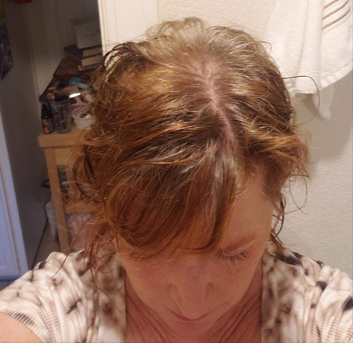 During chemotherapy for breast cancer, Lisa Lazzara of San Luis Obispo lost some hair around the crown of her head, but her cold-capping routine helped her preserve most of it.
