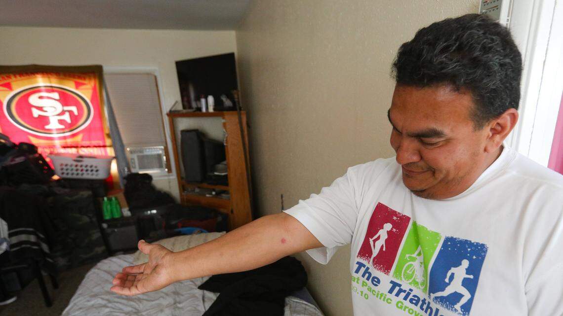 Francisco Ramirez shows a welt on his arm from a bedbug bite. Ramirez a three-year resident of Grand View Apartments, said black mold, bedbug bites, roaches and mice are common at the Paso Robles complex.