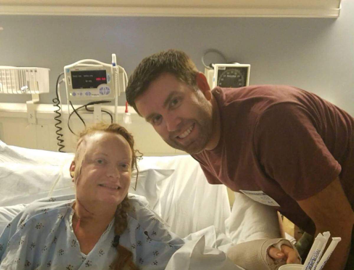 Christine Whaley and her husband, Tom, pose for a photo at UCLA in late 2017. The couple spent two weeks in Los Angeles when doctors removed cancer from Christine’s skull and grafted arteries, muscles and skin from her arm onto her head to promote blood flow. The surgery took about 10 hours and involved a dozen different doctors.