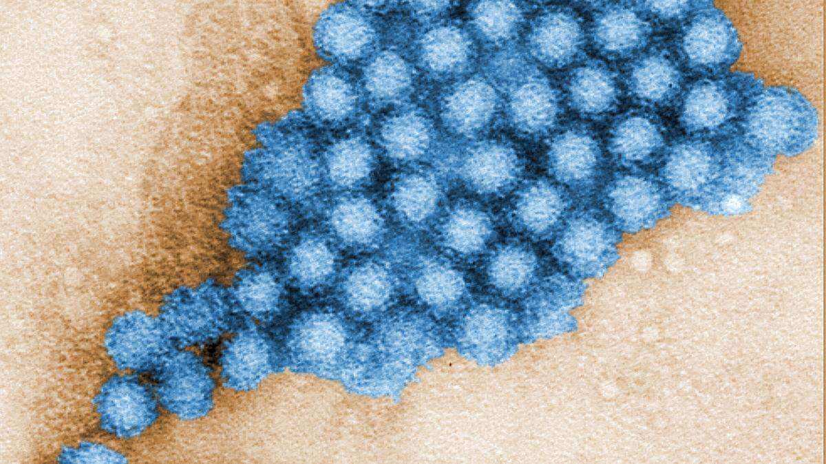 This transmission electron micrograph (TEM) revealed some of the ultrastructural morphology displayed by norovirus virions, or virus particles.