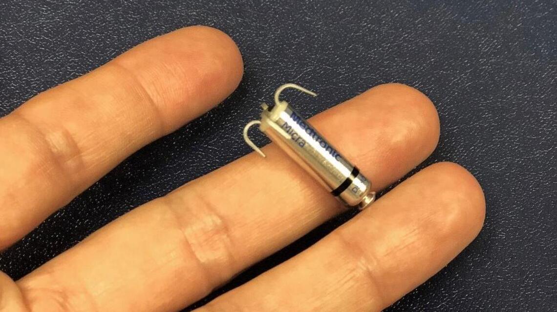 SLO hospital now offering the world’s smallest pacemaker