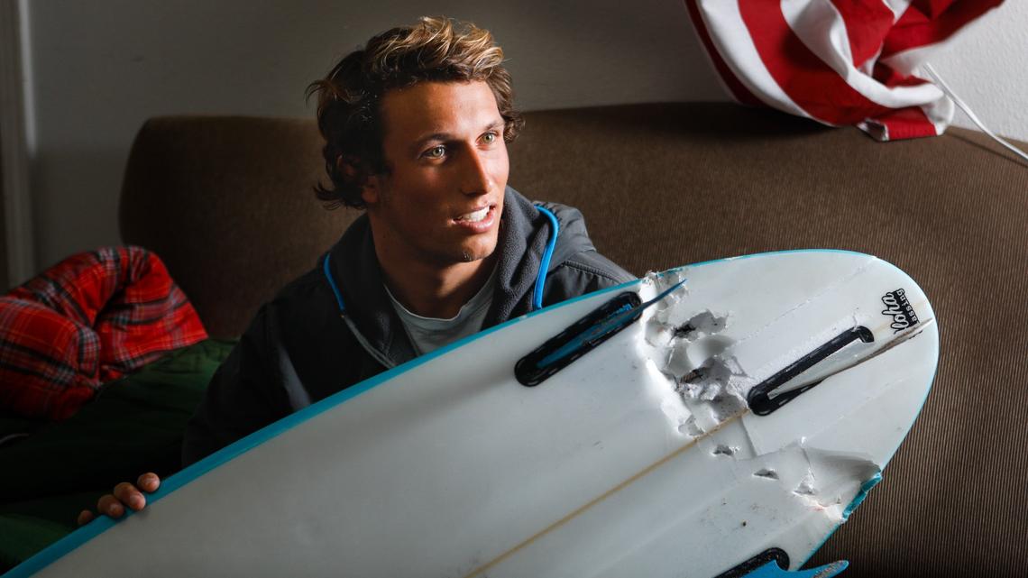 Nick Wapner, a 19-year-old Cal Poly student, who was attacked by a Great White Shark at Montana de Oro on Tuesday. Wapner suffered cuts to his legs and received 50 stitches. He kicked the shark in the head to break free of its grasp on his ankles. David Middlecamp 1-7-2019