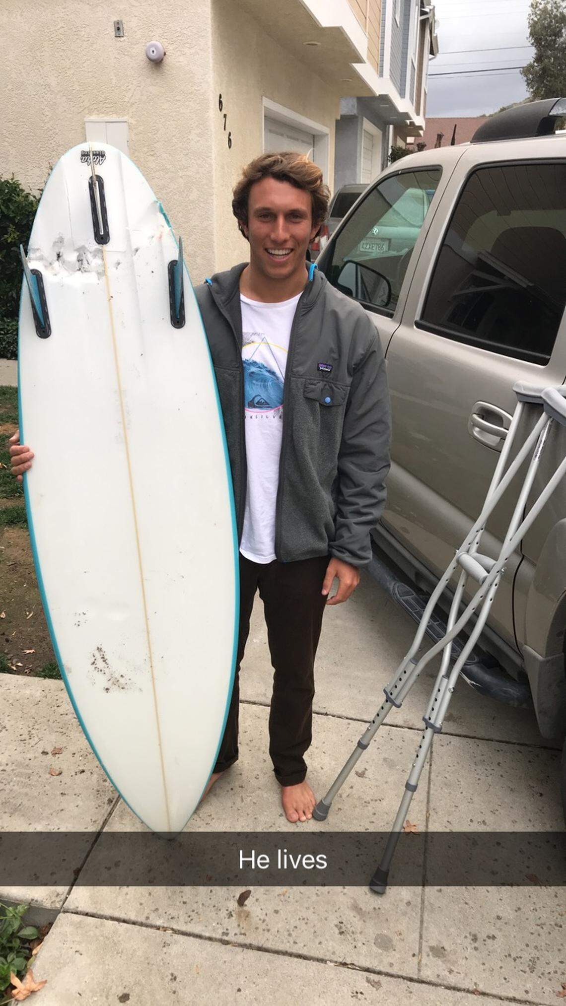 Cal Poly student Nick Wapner holds his damaged surfboard, gouged by a half-ring of teeth marks from one side to the other after a great white shark attacked him on Tuesday off Montaña de Oro State Park.