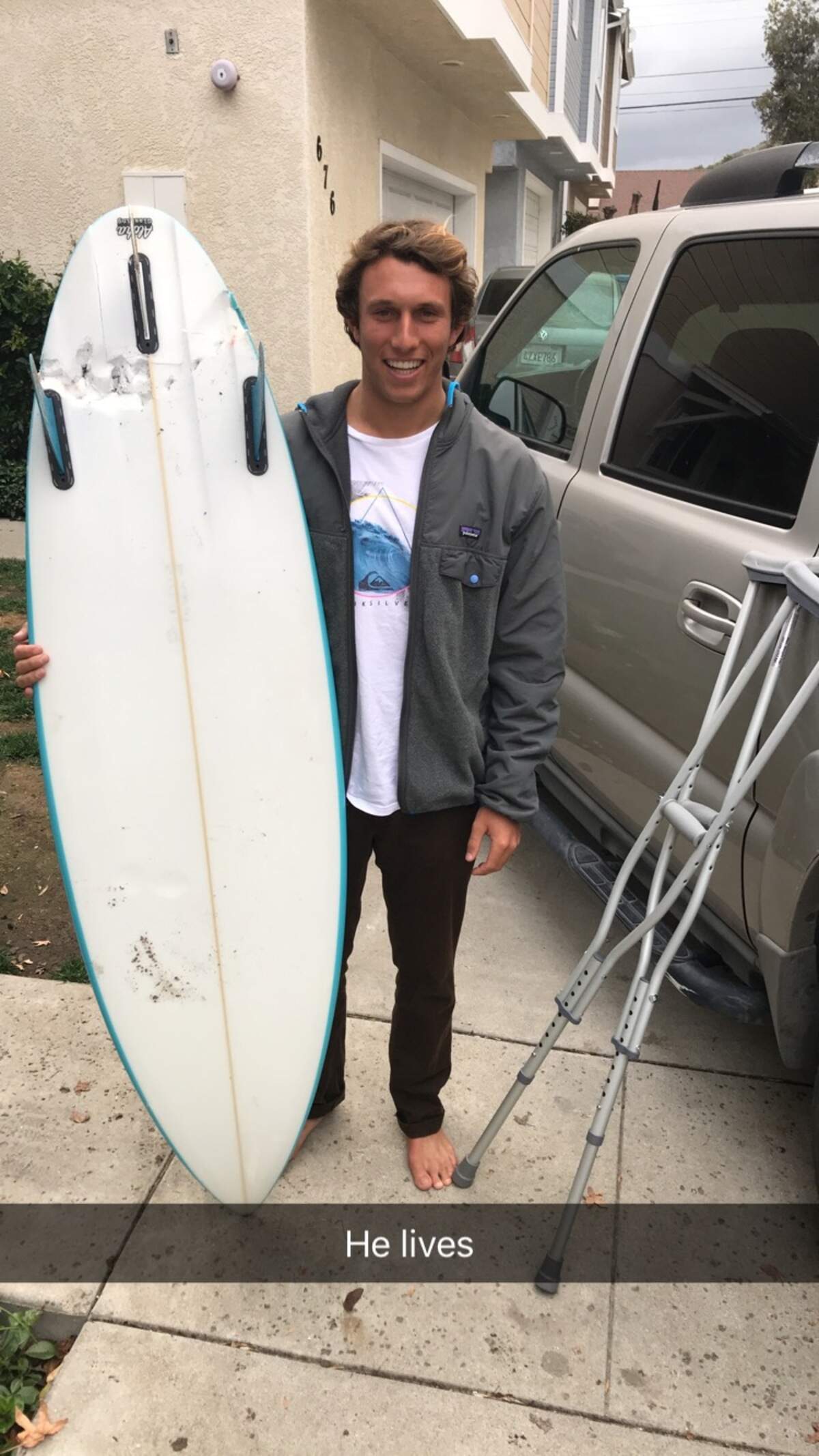 Cal Poly student Nick Wapner holds his damaged surfboard, gouged by a half-ring of teeth marks from one side to the other after a great white shark attacked him on Tuesday off Montaña de Oro State Park.