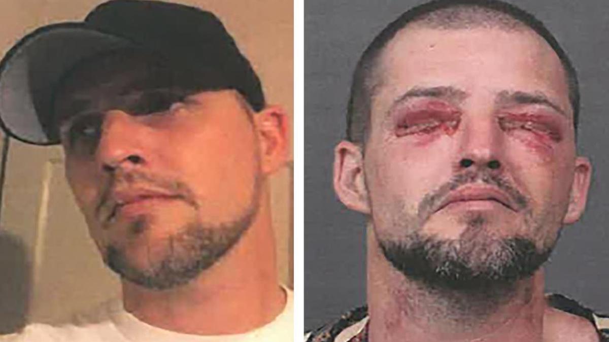 Jeremiah Mobley has filed a claim with San Luis Obispo County, alleging abuse at the County Jail, including lack of medical treatment for an eye infection.